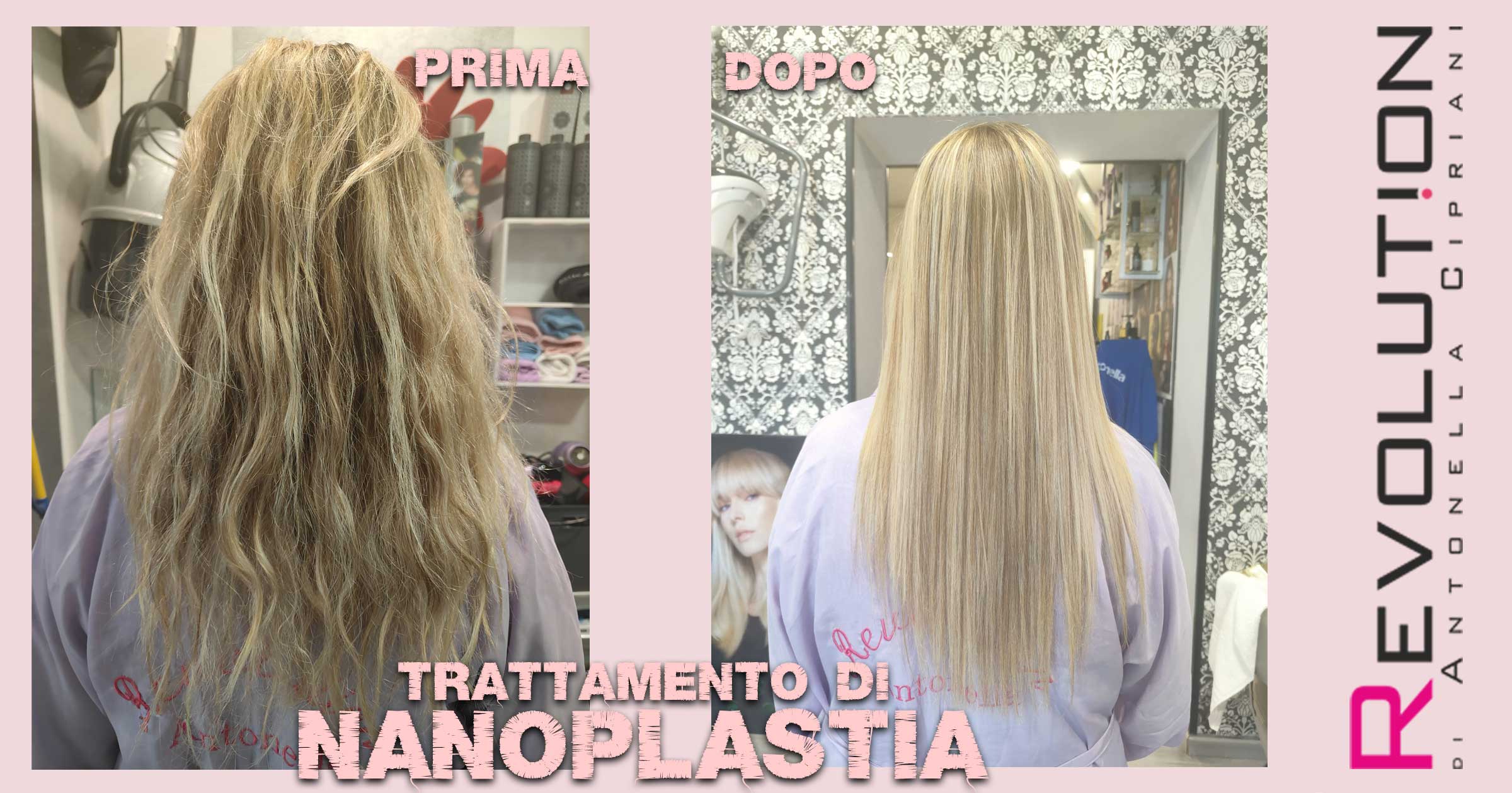 trattamento di nanoplastia