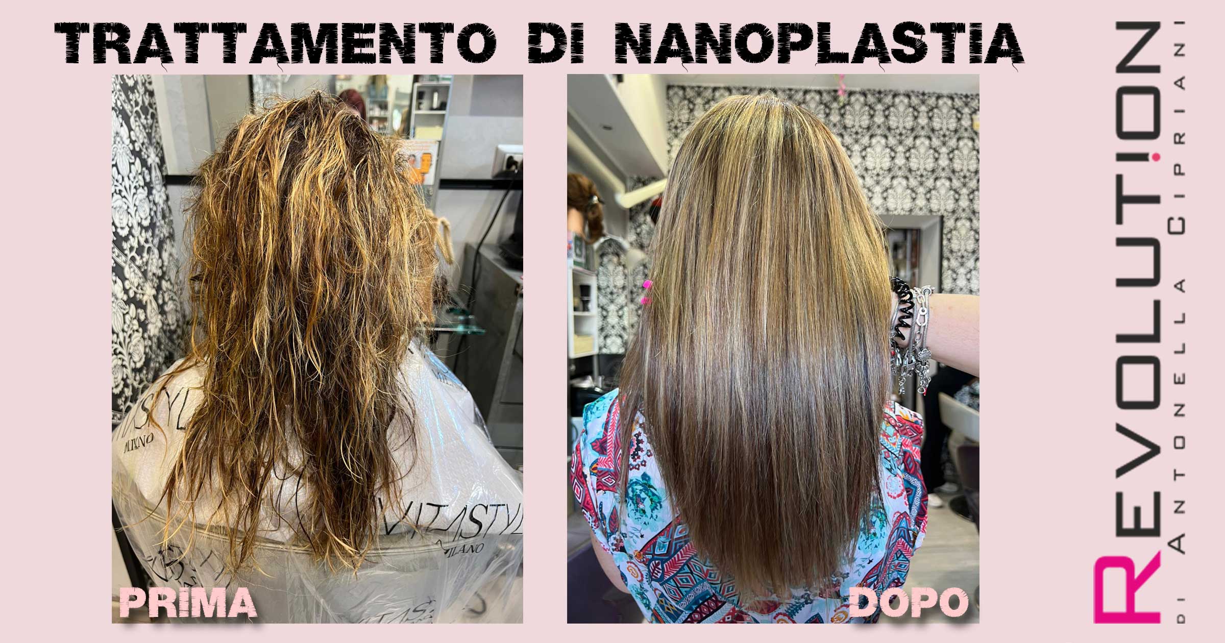 trattamento nanoplastia