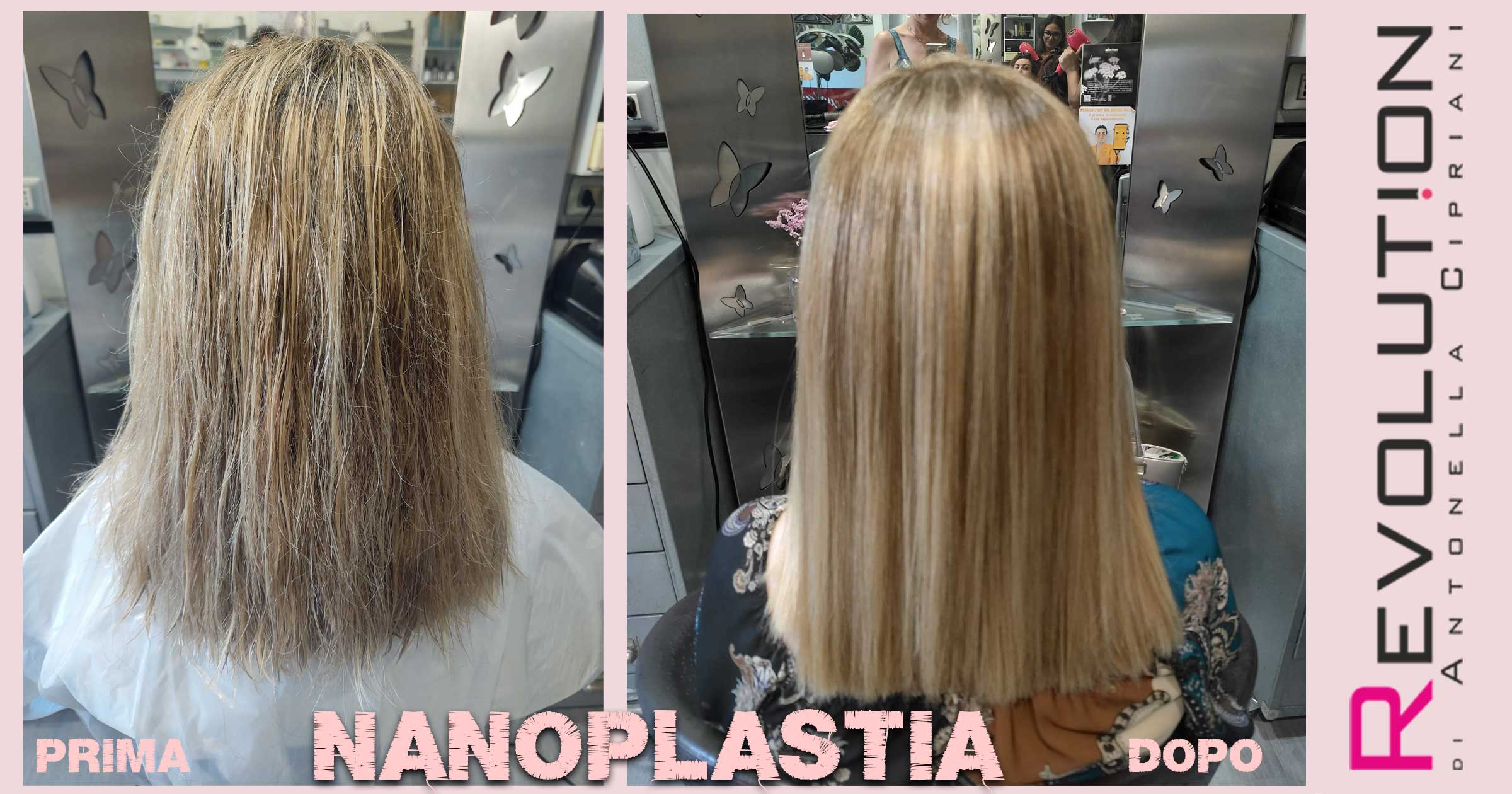 nanoplastia